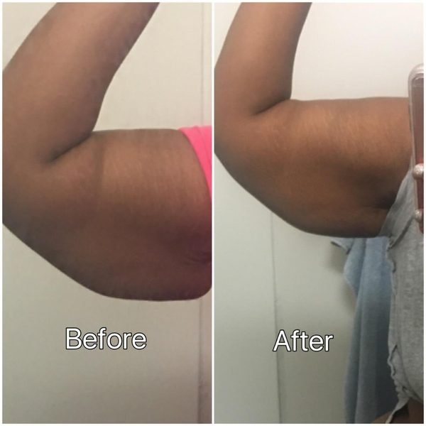 Before and after arm toning results with TNT Pro Ignite